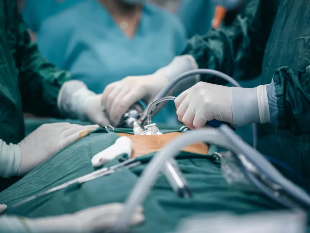 Photo by Zakir Rushanly: https://www.pexels.com/photo/doctors-during-operation-11748826/